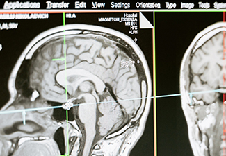 X-ray Bio Imaging