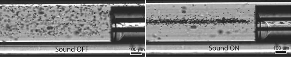 Visualizing the focusing effect of ultrasound on lysozyme crystals in microfluidics